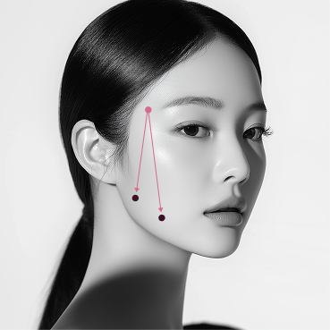 리프팅 패턴 3