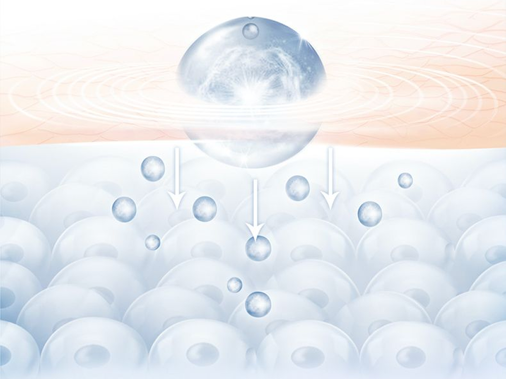 Thermage FLX