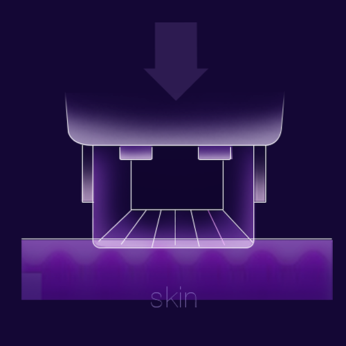 Thermage FLX
